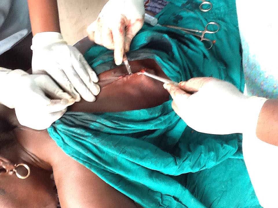 RAHI volunteer surgeons stitching the back of a patient with Lipoma after surgery