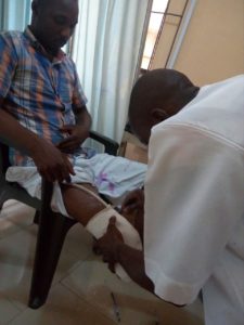 Fabrication-of-artificial-limb-for-payen